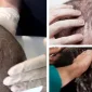 Saç Ekimine Karar Verdikten Sonra Alkol, Sigara Kullanımı